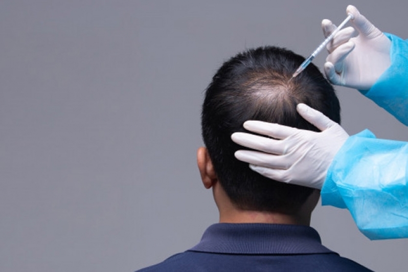 Ozonioterapia Capilar